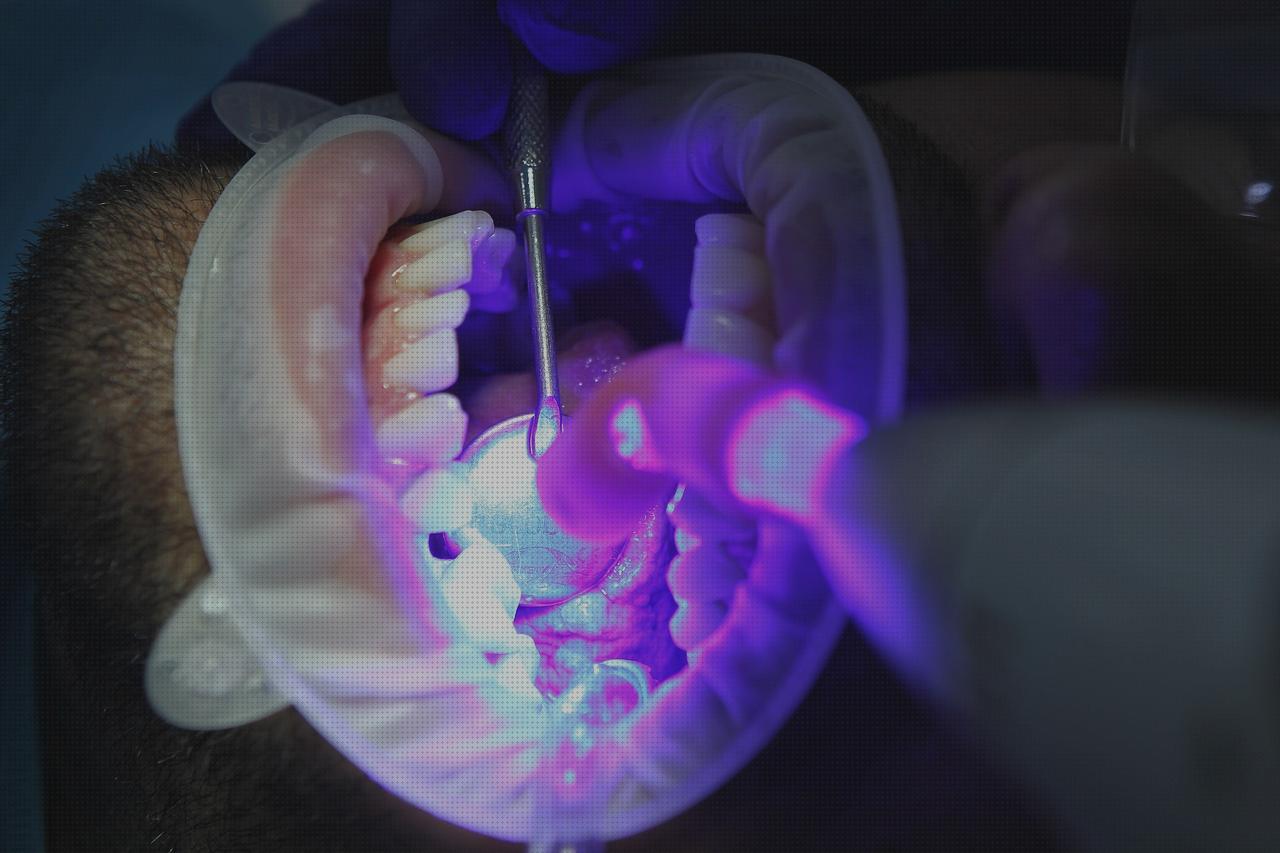 Los 23 Mejores Ferulas De Blanqueamientos Dentales