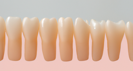 ¿Cuál es la frecuencia recomendada para realizar un tratamiento de blanqueamiento dental en casa?
