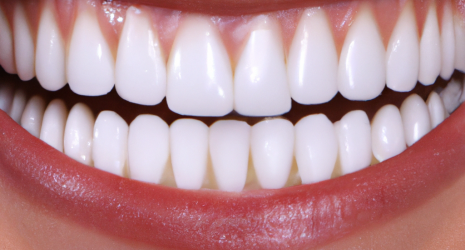 ¿Cuáles son los efectos secundarios más comunes del blanqueamiento dental con dispositivos?