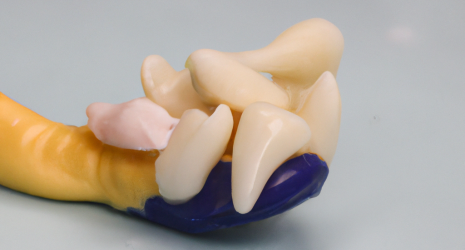 ¿Es mejor la pasta dental en gel o en crema?