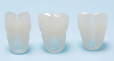 ¿Es posible combinar diferentes alternativas al blanqueamiento dental para obtener mejores resultados?