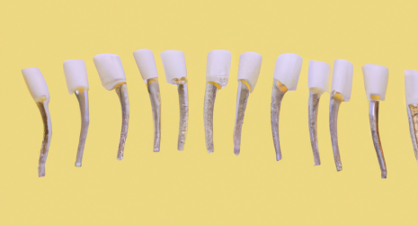 Los 5 enjuagues bucales más recomendados por dentistas