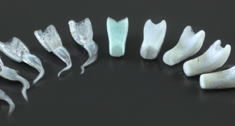 Los mejores enjuagues bucales para prevenir la placa y el sarro dental